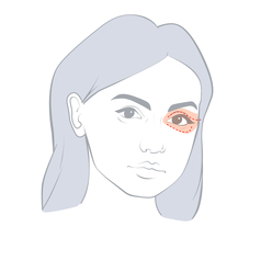 Eyelid Aesthetic