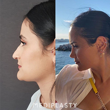 Nose Aesthetics