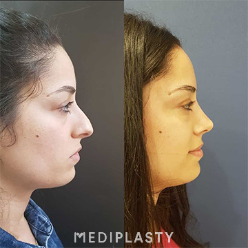 Nose Aesthetics