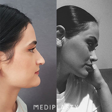 Nose Aesthetics