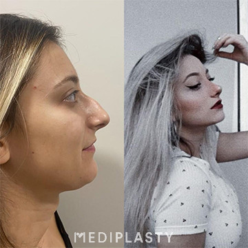Nose Aesthetics