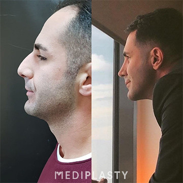 Nose Aesthetics