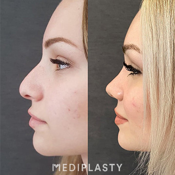 Nose Aesthetics