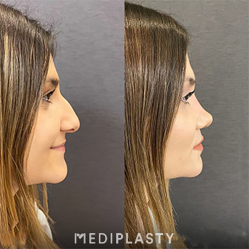 Nose Aesthetics
